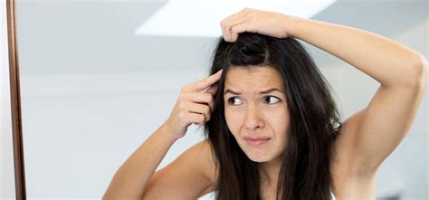 It isn't contagious or mild dandruff can be treated with a gentle daily shampoo. Can Dandruff Cause Hair Loss?
