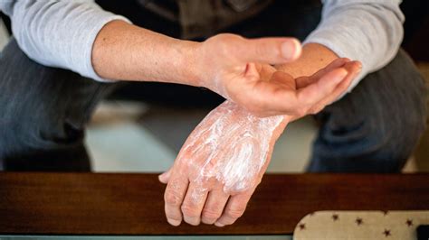 Psoriasis Vs Eczema What Is The Difference