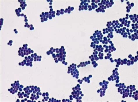 Staphylococcus Sp Simple Stain Methylene Blue Microlab 1