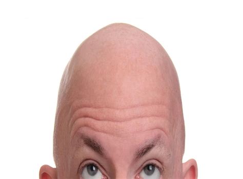 Researchers Think Theyve Found A Simple Cure For Baldness Indy100