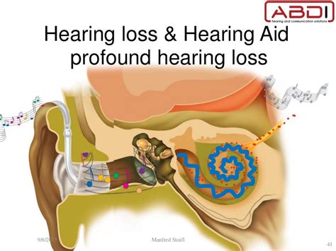Children And Hearing Loss