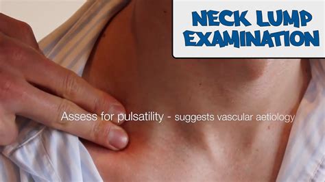 Examination Of A Neck Lump Osce Guide Old Version Youtube