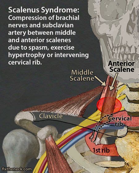 Remember our head attaches to our neck, and our neck attaches to our upper. Pin on Massage Therapy