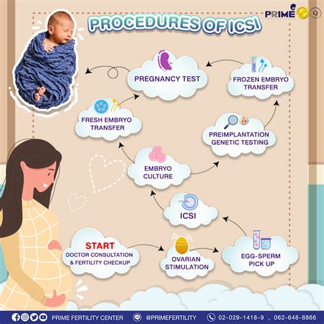 Procedure Of Icsi Prime Fertility Centerdr Poonkiativfiui