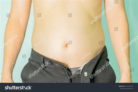 Overweight Man Trying Fasten Small Clothes Stock Photo