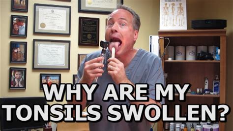 Natural Solutions For Swollen Tonsils How To Avoid A Tonsillectomy