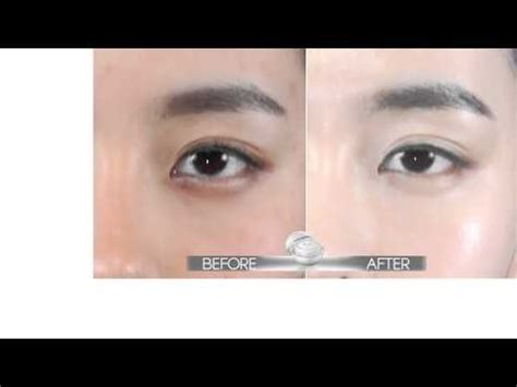 Armpit whitening lightening cream body legs elbow skin whitening cream. Rizette Magic Whitening Cream + - YouTube