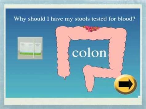 Stool Hidden Blood Test At Dhp Youtube