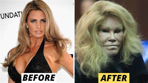 Celebrity Plastic Surgery Disasters Youtube Celebrity Surgery