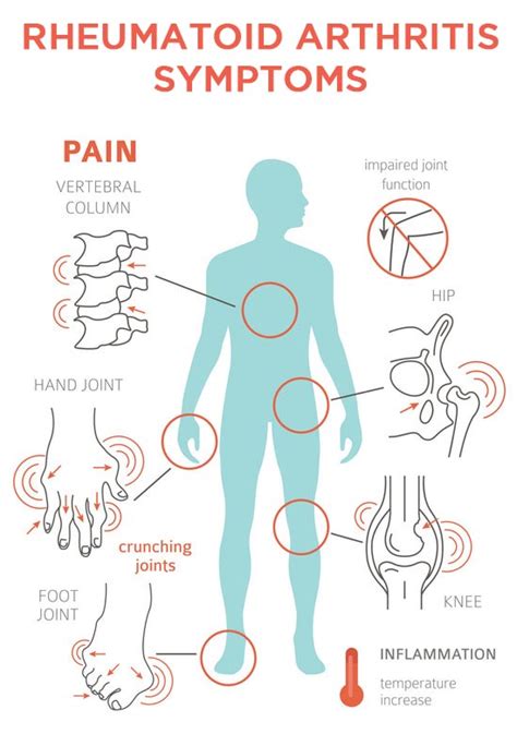 50 Arthritis Rheumatoid Symptoms Background Propranolols