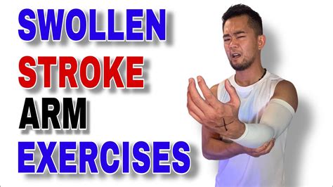 Relieve And Restore The Ultimate Stroke Arm Swelling Exercise Program