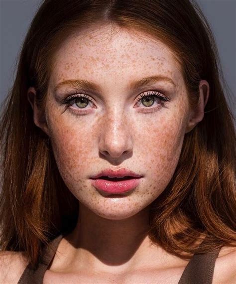 Pin By Govidio On 10000 Redhead Girls Beautiful Freckles Freckles