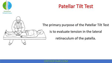 Patellar Tilt Test Easy Explained Orthofixar 2022 Therapy Humor