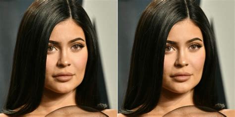 What Kylie Jenners Lips Look Like Without Lip Fillers And Why She
