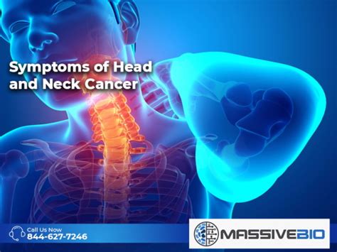 Symptoms Of Head And Neck Cancer Massive Bio