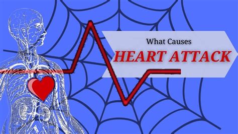 Cause Of Heart Disease Web Of Disease Causation Youtube