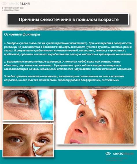 Как снять отечность глаз после слез быстро