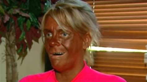 Mom Of Obsessed With Tanning Was Accused Of Burning Her Year Old In A Tanning Booth