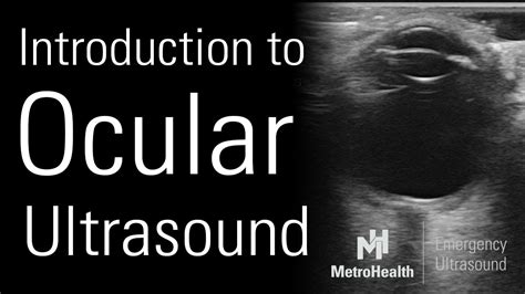 Introduction To Ocular Ultrasound Youtube