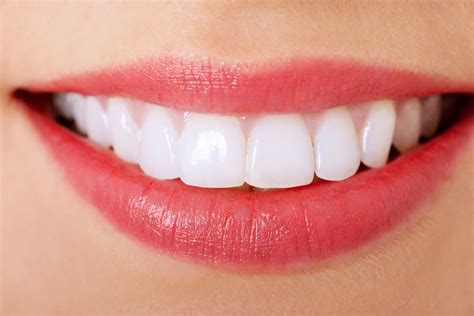 Top 10 Remedies For Receding Gums Receding Gums Get Whiter Teeth Dental