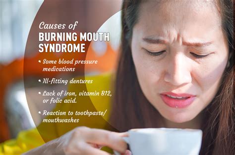 What Is Burning Mouth Syndrome Causes Symptoms Tips D