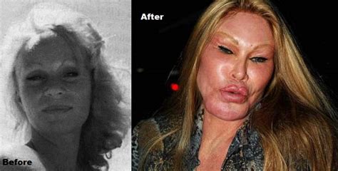 The Top 10 Women With The Most Plastic Surgeries Therichest
