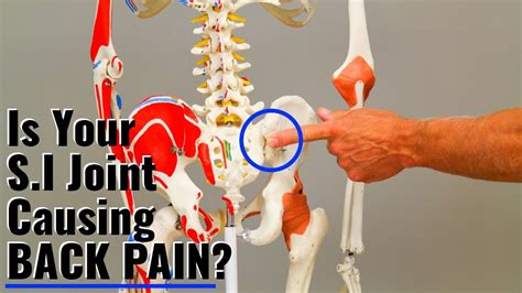 Pain Along Iliac Crest