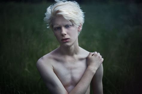58 Albino People Who’ll Mesmerize You With Their Beauty