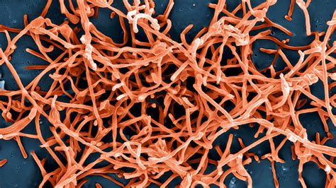 Nigerian authorities have put health workers on red alert following the resurgence of. Diagnosing Ebola in the Field | The Brink | Boston University