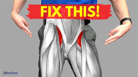 How To Relieve Hip Flexor Pain In Seconds Spinecare