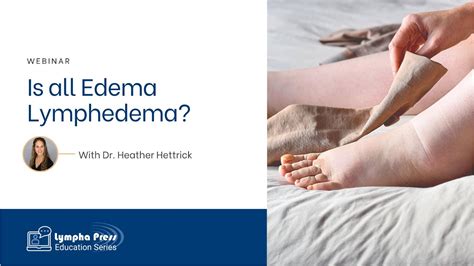 Is All Edema Lymphedema Dr Heather Hettrick Youtube