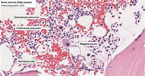 Bone Marrow Normal Histology Nus Pathweb Nus Pathweb