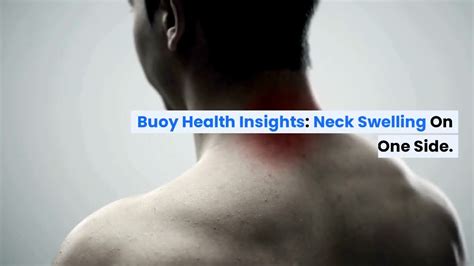 Neck Swelling On One Side Common Causes And When To Seek Medical Care