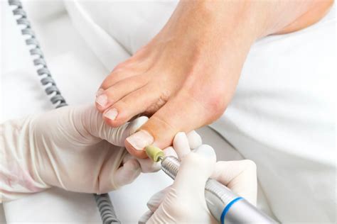 What Is Cosmetic Podiatry Round House Podiatry