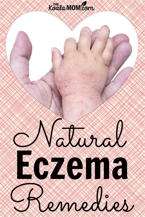 Natural Eczema Remedies Natural Eczema Remedies Eczema Remedies Eczema