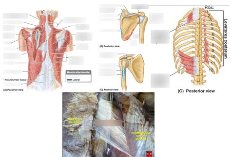 1027 Extrinsic Back Muscles Anatomy Diagram Quizlet