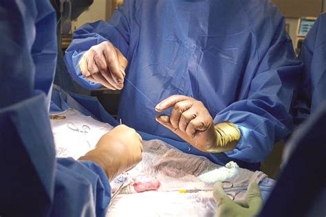 Foto Pertama Kalinya Transplantasi Ginjal Babi Ke Tubuh Manusia Berhasil