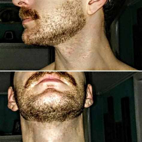 Pin By Danjo On Anatomy Neck Beard Beard Care Beard