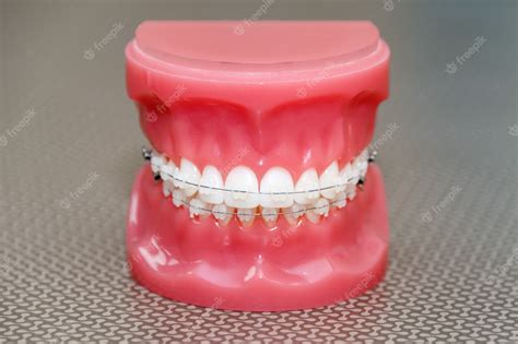 Premium Photo Orthodontic Model And Dentist Tool Demonstration