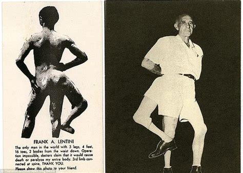 Frank Lentini Three Legged 16 Fingered And Two Genital Juggler Imedia