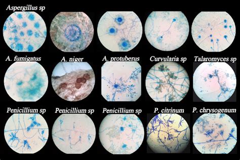 Isolated Filamentous Fungi Observed Microscopically Download
