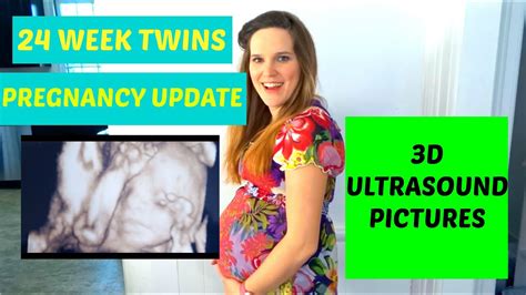 Welcome to my gallery of ultrasound images i intend to make this a large library of ultrasound images obtained from my own collection and that of friends in the medical world. 24 WEEK TWINS PREGNANCY UPDATE: 3D ULTRASOUND PICTURES ...