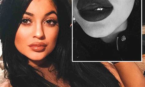 Kylie Jenner Shares Another Selfie Of Overtly Plump Pout