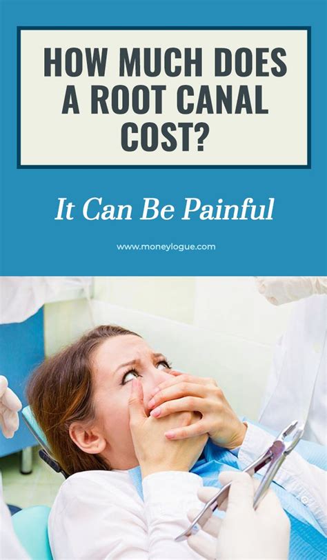On average, dental insurance helps pay around $400 towards a dental crown. How Much Does a Root Canal Cost? It Can Be Painful (With images) | Root canal, Endodontist ...