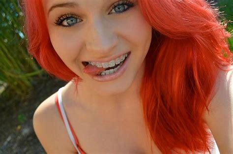 Hot Readhead With Braces Stunning Red Haired Girl With Ama Flickr