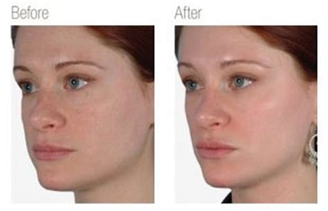 We did not find results for: VITAMIN C - The Secret to Flawless Skin - Lumina Skin