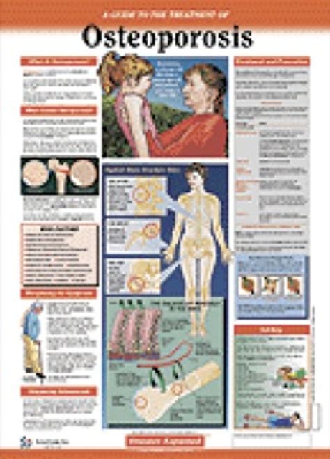 Osteoporosis Patient Anatomical Chart Clinical Charts And Supplies