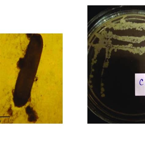 Pdf Microbiological And Genetic Characteristics Of Bacillus