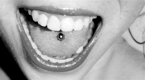 Concerns With Oral Piercings Registered Dental Hygienists