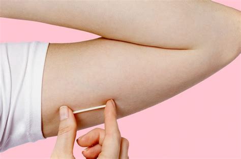 Noticia Colocarán Hoy Implantes Subdérmicos Anticonceptivos A Mujeres De Hasta 19 Años